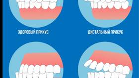 Что значит изменяемая часть в Борк